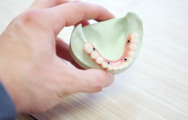Rehabilitación Oral